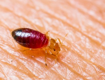 Bedbugs on Skin